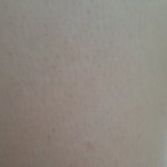 [꼭조언부탁] (혐주의) 내 피부 왜<b>이럼</b>
