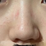 [이것좀봐줘] 내 코 어때 <b>복코</b> 맞지
