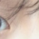 [드루와] 쌍수 2<b>달차</b> 후기