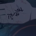 낼 충치치료하는데(<b>미방</b>