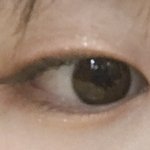 [댓글부탁해] <b>쌍수</b> 할지 말지 골라줘!!!!