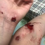 [댓글부탁해] 혐)얘들아 나 학원<b>가다</b> 넘어졌어ㅠㅠㅠ