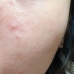 [댓글부탁해] 너네 트러블 생기면 어떻게 해결해?