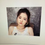 [댓글부탁해] <b>양악</b>수술+앞트임+코+입술필러로 진짜 이뻐진 비제이