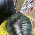 [꼭조언부탁] (혐주의)얘들아 나 <b>탈모인</b>것 같니..?