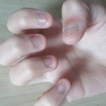 [댓글부탁해] 나 <b>손톱</b> 물어뜯는버릇 있는데ㅜ