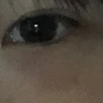 눈밑에 이거다크<b>서클</b>인가