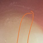 얘들아 나 <b>치아</b> 금갔는데 이거 어떡해ㅠㅠ?