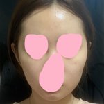 [댓글부탁해] 나 <b>얼굴</b>형 <b>개</b>망했어?ㅠㅠ