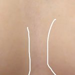 [19] 75C인데 가슴 나만이래?ㅜㅠ