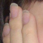 나 손가락 굳은살 두 <b>개임</b>