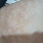 혐주의)어깨 <b>색이</b> 얼룩덜룩해요