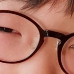 [드루와] 2년동안 쌍수없이 이 <b>변화</b> ㄱㄴ? ㅋㅋㅋㅋㅋ