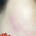 얘들아 나 이거 <b>알러</b>지 있는거임?