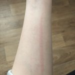 너네도 <b>손톱</b>으로 피부 살짝 긁으면