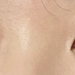 [조언부탁해] 쌍수해도 <b>쌍꺼풀</b> 짝짝이야??