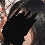 혐짤)더샘 컨실러 쓰고 <b>모낭염</b>으로 얼굴 오염됨