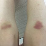 현대무용 하는 사람의 다리••=(나)