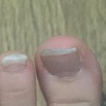 헿헿헿헿헿헿헿헿헿헿헿헿헿헿 1달 안깎<b>발톱</b>