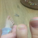 <b>발톱</b> 짤랏어