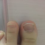 나 왤케 <b>발톱</b>이 작을까...?