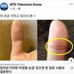 [댓글부탁해] 돈 많은 사람과 결혼한 <b>손금</b>