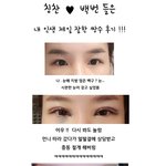 [이것좀봐줘] 쌍수 완전 마음에 듬 . 다이어트 8kg 뺌 !!...