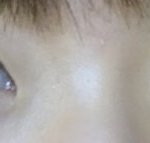 재<b>쌍수</b> 할까..? 추반좀