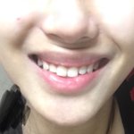 [19] ㅁㅊ 나 입술 왜이런거야??ㅜㅜ
