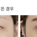 이런 눈은 절대 <b>쌍수</b>하면 안됨