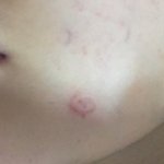 <b>볼펜</b>으로보조개만드는법이라는데