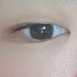 쌍수하면 떡상할 <b>눈</b>임? (<b>눈</b> 따로따로 찍음)