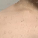나 승모근 졸ㄹ라 심함 ㅆㅂ