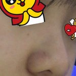 얘들아 나 <b>콧대</b> 할 까..?