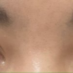 [댓글부탁해] 쌍수<b>재수술</b>할까?ㅠㅠ