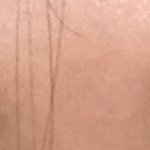 이거이마<b>거상</b><b>수술</b> 가능함?한쪽만