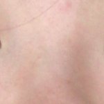 [조언부탁해] 내 코는 <b>쉐딩</b> 어케행