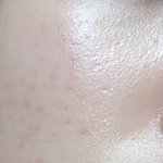 나 피부 평가좀