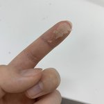 [드루와] 입술 <b>각질</b> 뗐는데 ㅈㄴ 레전드임