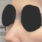 [댓글부탁해] <b>콧대</b>랑 코 평가좀해줭 ㅠ