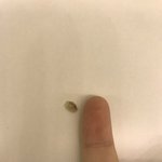 ㅅㅂ내 배꼽에서 개쩌는거 나옴;;;