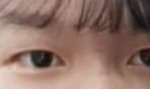 <b>무쌍</b> 쌍수 할말ㅜㅜ