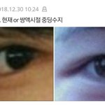 [댓글부탁해] 나 <b>이</b> 오른쪽 <b>눈</b>이랑 완전 똑같은데