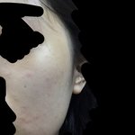 [드루와] 뒤집어진 피부에 효과 개쩌는거 알려줌