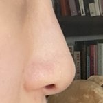 여기 나보다 코 심한 애 없을거라고 장담함