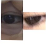 쌍수<b>전후</b> 어때