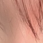 [댓글부탁해] <b>쌍수</b> 2년차ㅠㅠ