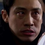 [드루와] 교정 스크류 박은 후기...