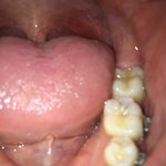 충치어<b>카노</b> ㅅㅂ