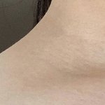 목만 ㅈㄴ 까만 거 어떡하냐